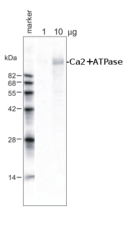 western blot using Ca2+ ATPase antibodies 